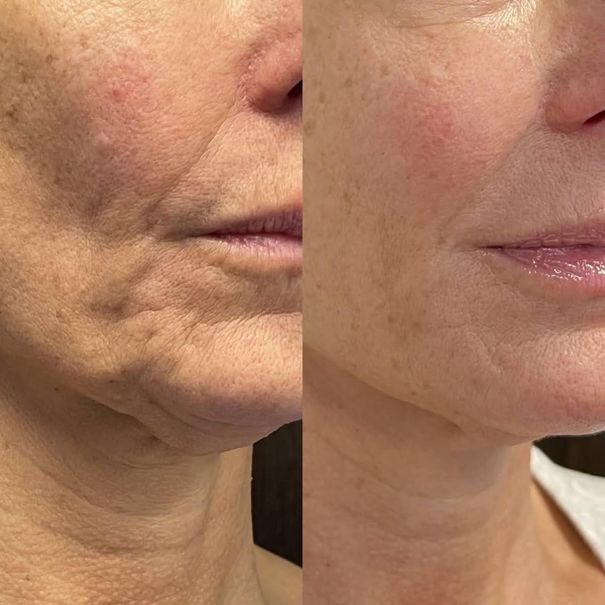 Fine Lines + Wrinkles comparison photos accompanying Megan T.’s review