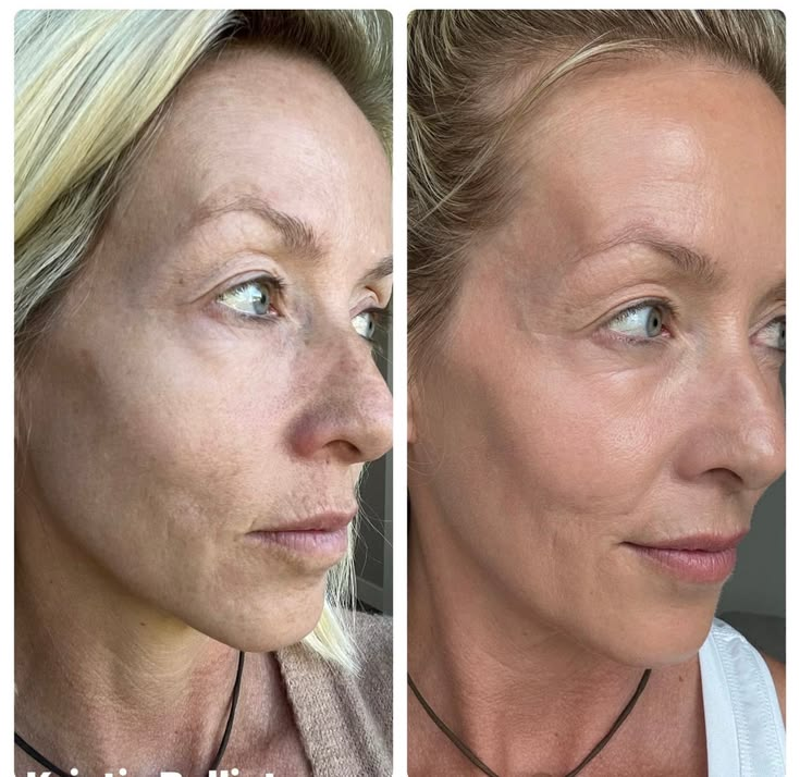 Dry Skin comparison photos accompanying Emily K.’s review